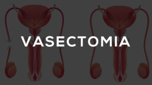 vasectomia campo grande ms